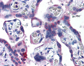 EVC2 Antibody in Immunohistochemistry (Paraffin) (IHC (P))