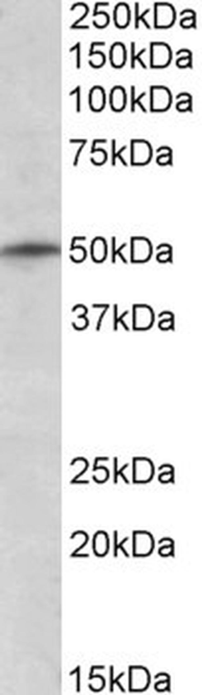TRIM35 Antibody in Western Blot (WB)