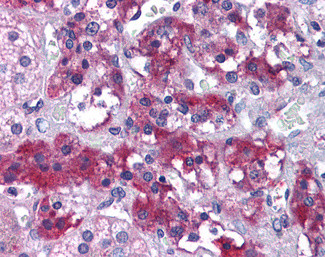 MERTK Antibody in Immunohistochemistry (Paraffin) (IHC (P))