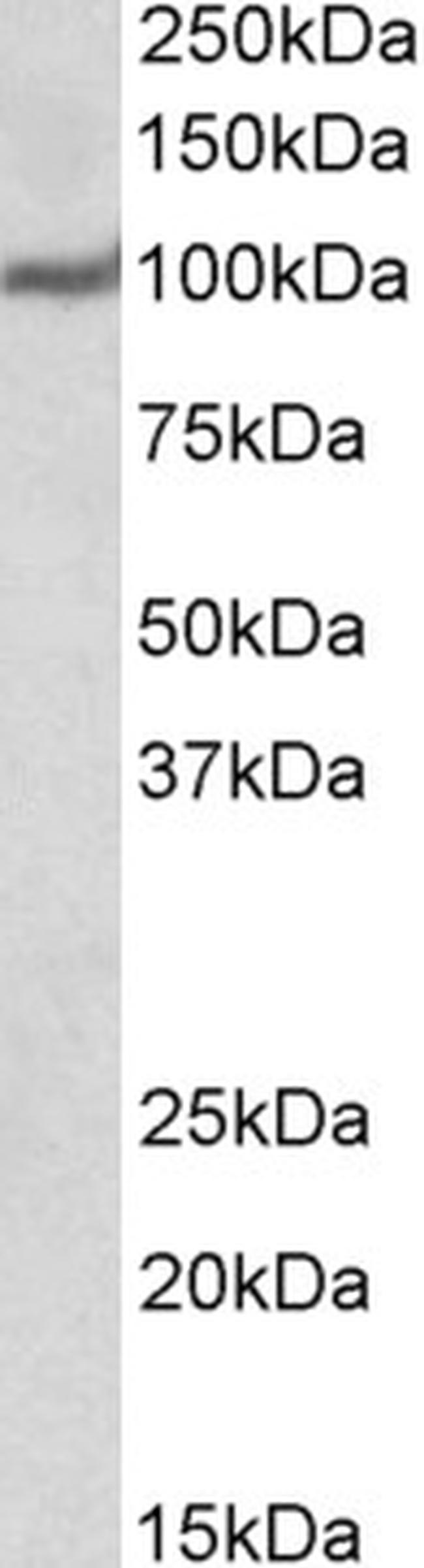 USP4 Antibody in Western Blot (WB)