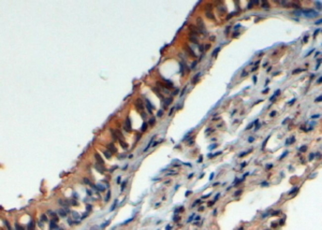 FBXL12 Antibody in Immunohistochemistry (Paraffin) (IHC (P))