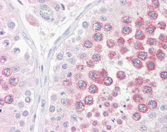 BOLL Antibody in Immunohistochemistry (Paraffin) (IHC (P))