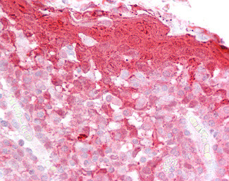 Cystatin B Antibody in Immunohistochemistry (Paraffin) (IHC (P))