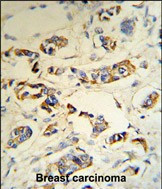 C1QA Antibody in Immunohistochemistry (Paraffin) (IHC (P))