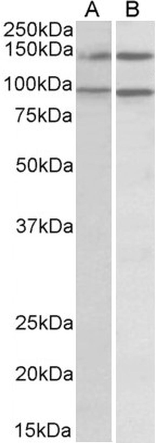 ARHGEF18 Antibody in Western Blot (WB)