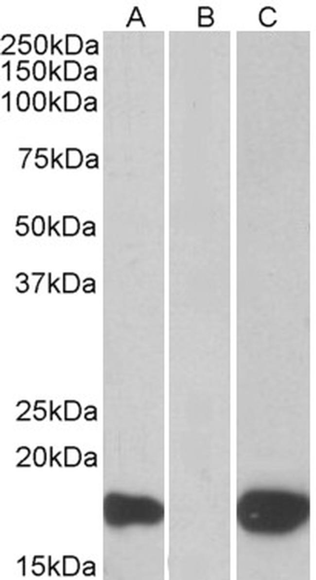 PHLDA3 Antibody in Western Blot (WB)