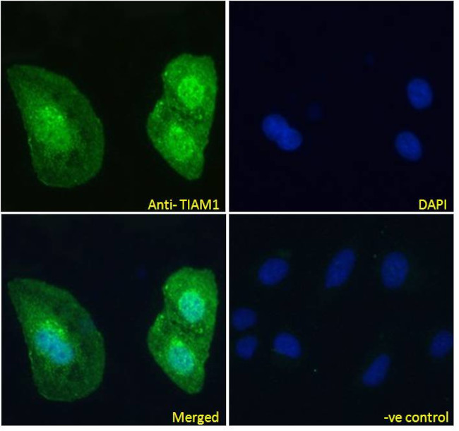 TIAM1 Antibody in Immunocytochemistry (ICC/IF)