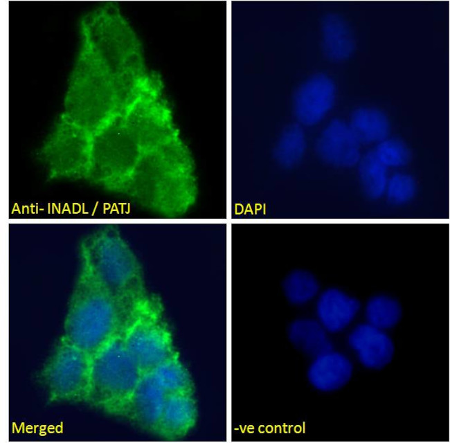 Patj Rnascope PATJ Polyclonal Antibody | Invitrogen (PA5-142086)