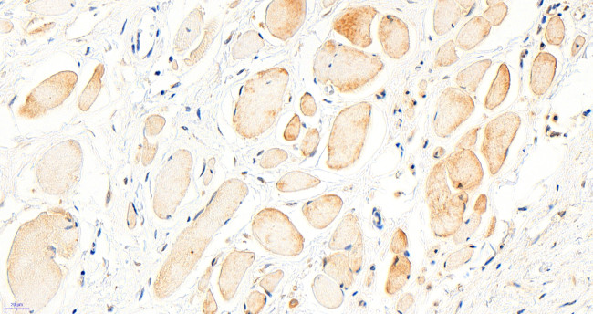 BTRC Antibody in Immunohistochemistry (Paraffin) (IHC (P))