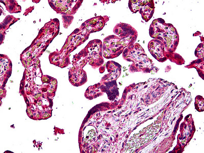 SNX4 Antibody in Immunohistochemistry (Paraffin) (IHC (P))