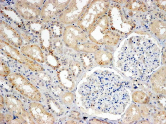 SNX8 Antibody in Immunohistochemistry (Paraffin) (IHC (P))