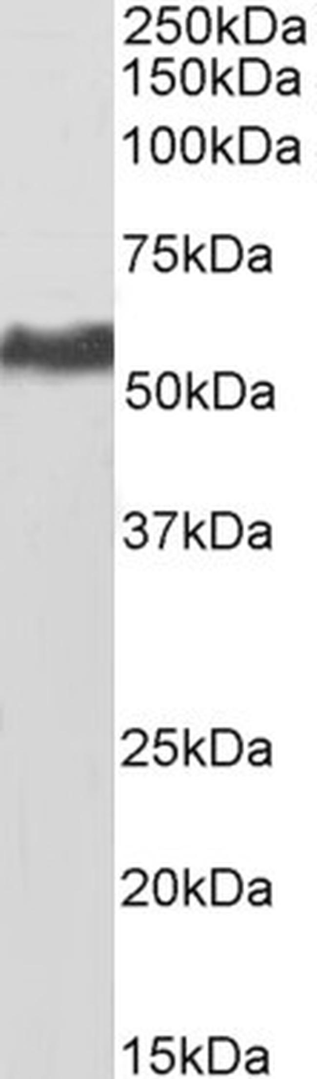 KPNA2 Antibody in Western Blot (WB)