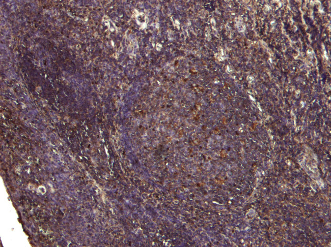 PDZD2 Antibody in Immunohistochemistry (Paraffin) (IHC (P))