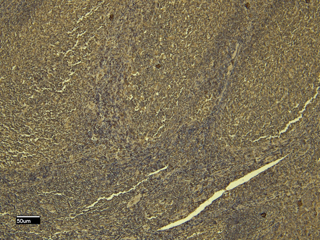 SCRIB Antibody in Immunohistochemistry (Paraffin) (IHC (P))