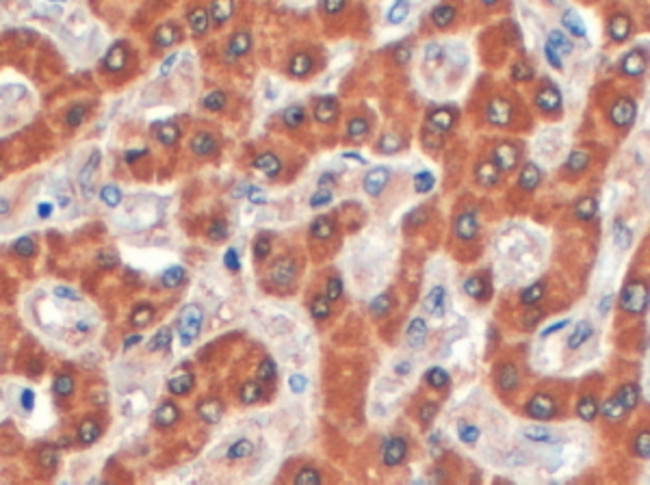 Syntenin 2 Antibody in Immunohistochemistry (Paraffin) (IHC (P))