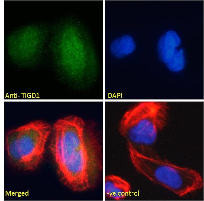 TIGD1 Antibody in Immunocytochemistry (ICC/IF)