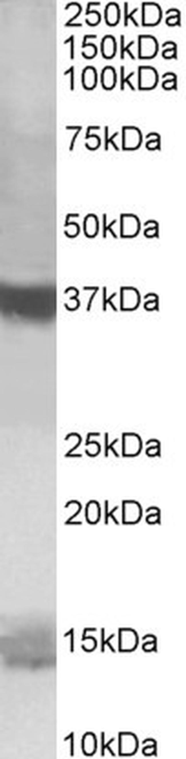 PFDN1 Antibody in Western Blot (WB)
