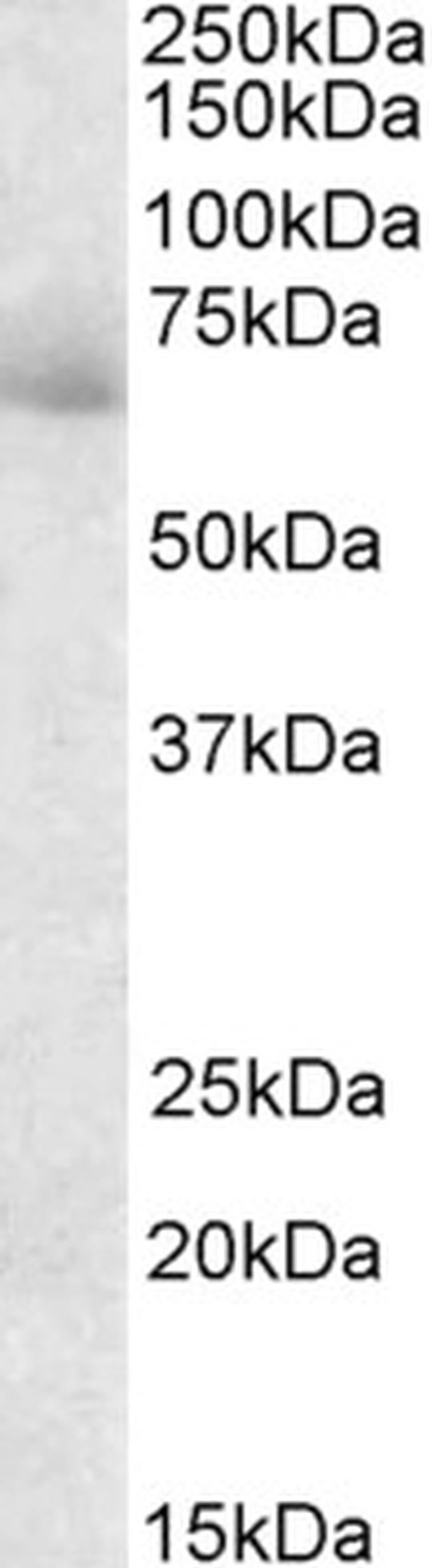 AKAP10 Antibody in Western Blot (WB)