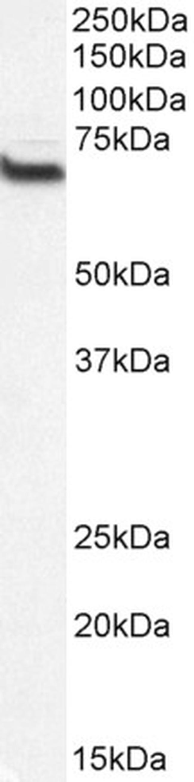 CMG1 Antibody in Western Blot (WB)