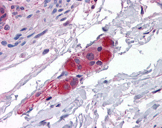 MRCK alpha Antibody in Immunohistochemistry (Paraffin) (IHC (P))
