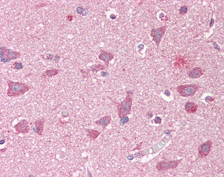 GRASP1 Antibody in Immunohistochemistry (Paraffin) (IHC (P))