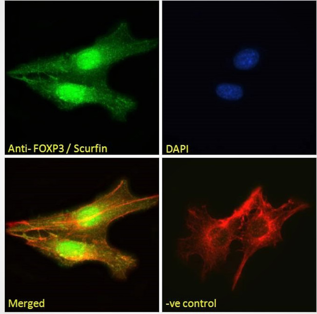 FOXP3 Antibody in Immunocytochemistry (ICC/IF)
