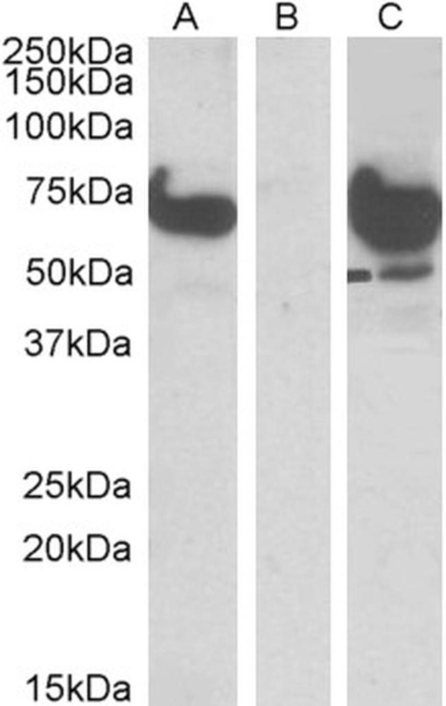 EPM2AIP1 Antibody in Western Blot (WB)