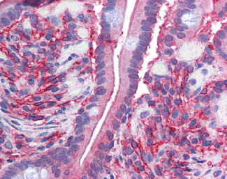 CYBRD1 Antibody in Immunohistochemistry (Paraffin) (IHC (P))
