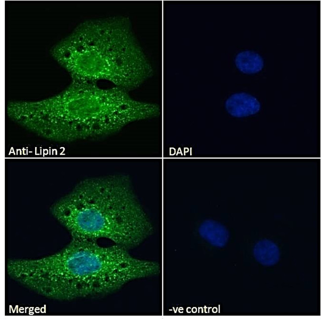 LPIN2 Antibody in Immunocytochemistry (ICC/IF)