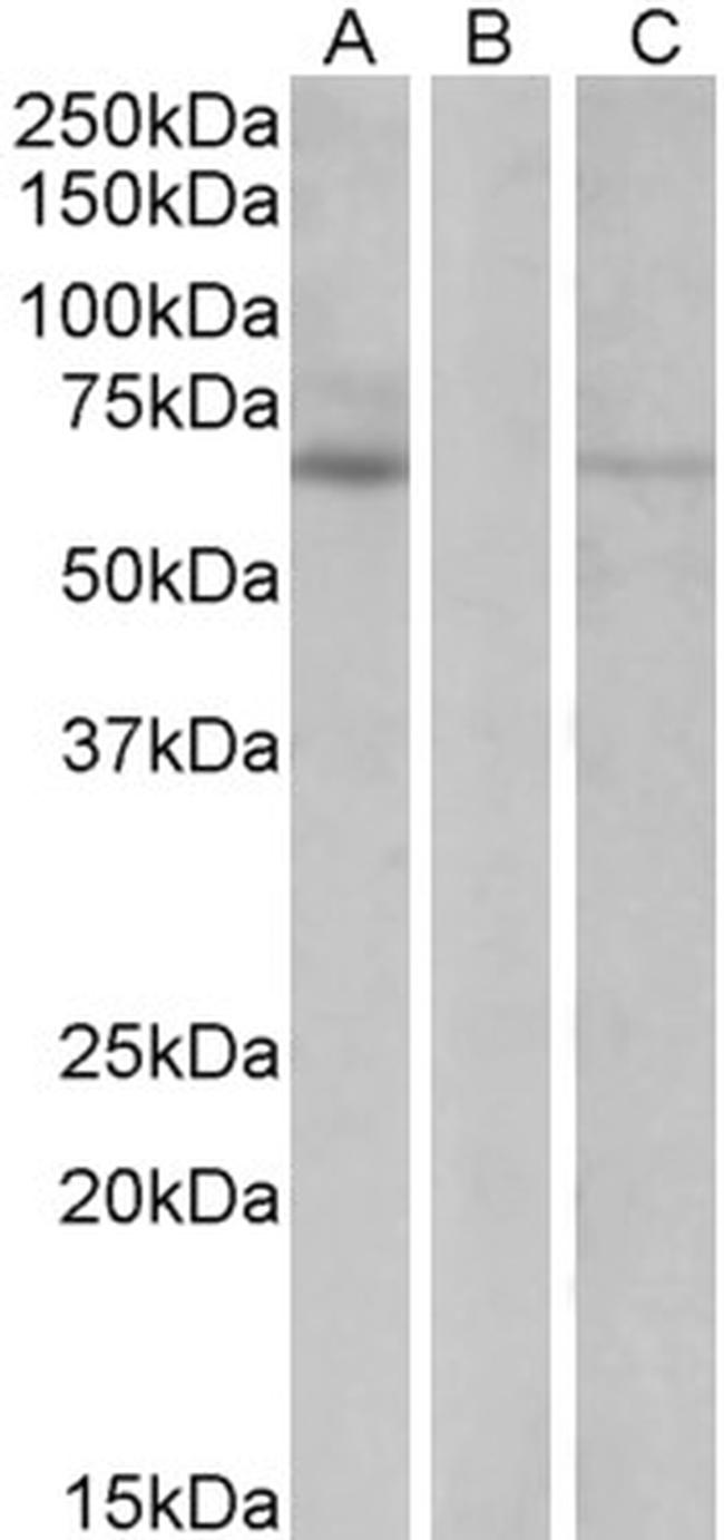 MKRN1 Antibody in Western Blot (WB)