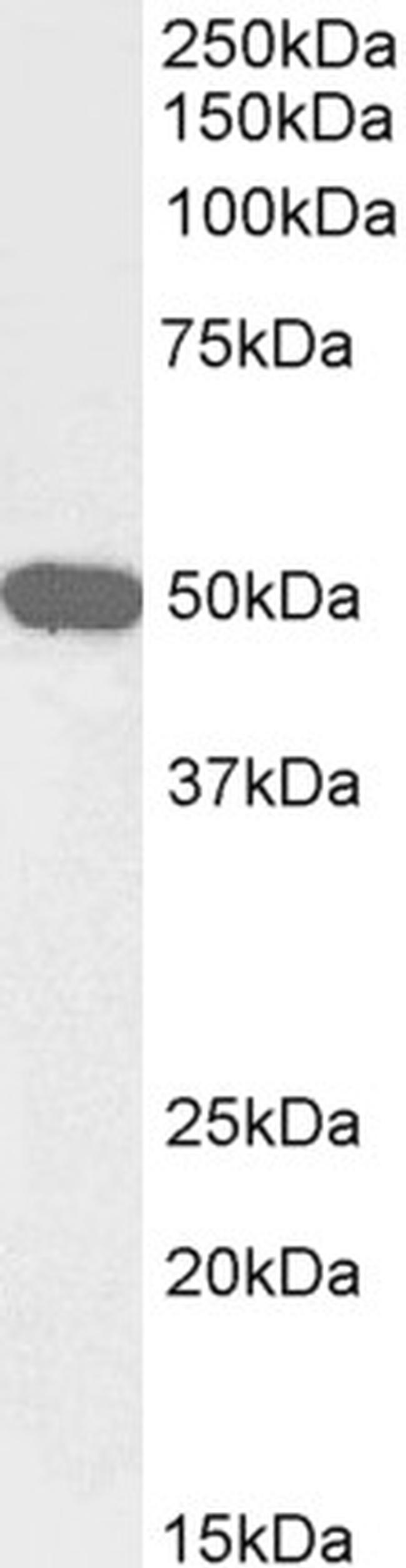 NPY5R Antibody in Western Blot (WB)