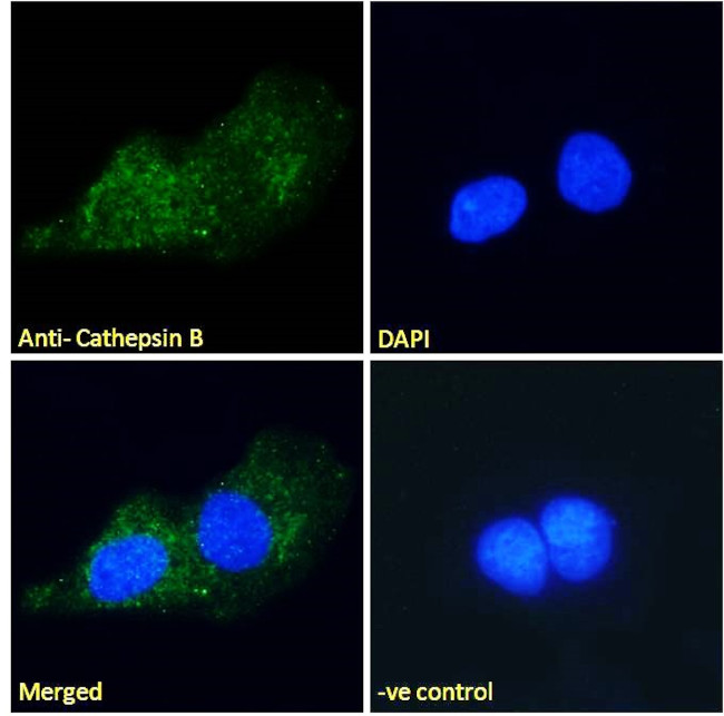Cathepsin B Antibody in Immunocytochemistry (ICC/IF)