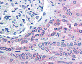RHPN2 Antibody in Immunohistochemistry (Paraffin) (IHC (P))