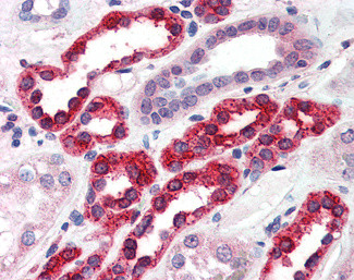 GGA3 Antibody in Immunohistochemistry (Paraffin) (IHC (P))