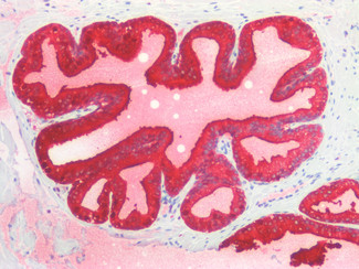PSA Antibody in Immunohistochemistry (Paraffin) (IHC (P))