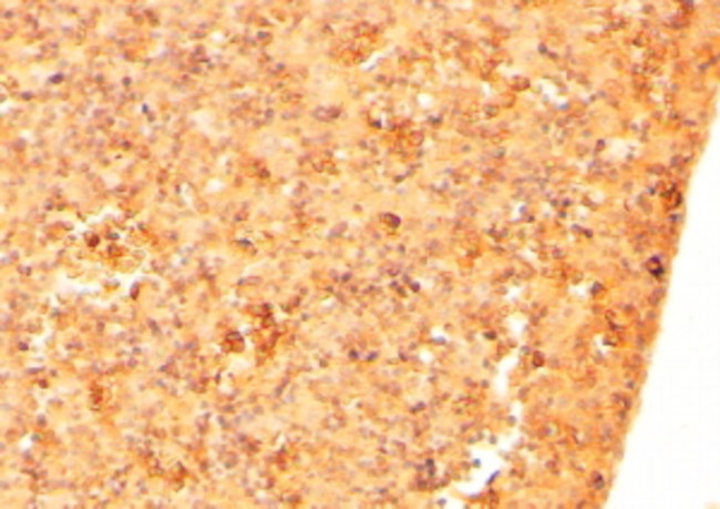Cryptic Antibody in Immunohistochemistry (Paraffin) (IHC (P))