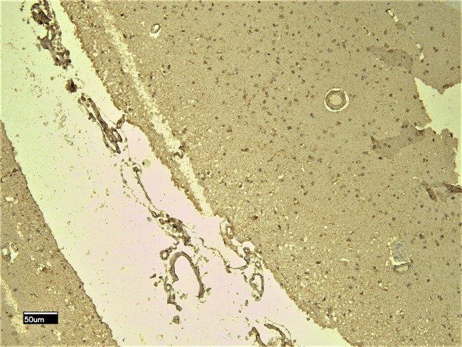 SCN5A Antibody in Immunohistochemistry (Paraffin) (IHC (P))