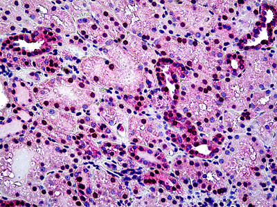 TIN2 Antibody in Immunohistochemistry (Paraffin) (IHC (P))