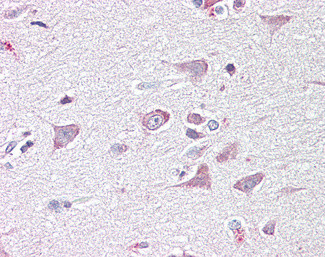 GOLGA6B Antibody in Immunohistochemistry (Paraffin) (IHC (P))