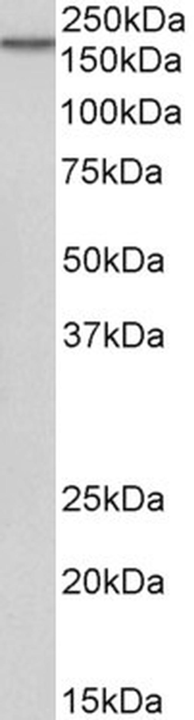 EGFR Antibody in Western Blot (WB)