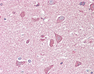 NCAM2 Antibody in Immunohistochemistry (Paraffin) (IHC (P))