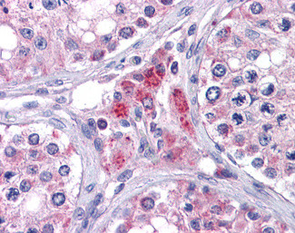 EYA4 Antibody in Immunohistochemistry (Paraffin) (IHC (P))
