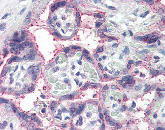 NOTCH3 Antibody in Immunohistochemistry (Paraffin) (IHC (P))