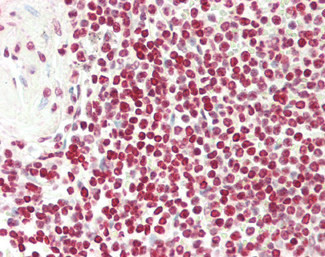 FOXP3 Antibody in Immunohistochemistry (Paraffin) (IHC (P))