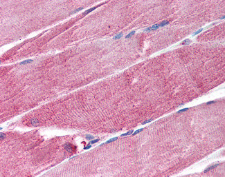MURF1 Antibody in Immunohistochemistry (Paraffin) (IHC (P))