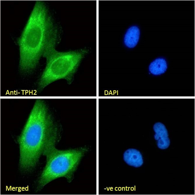 TPH2 Antibody in Immunocytochemistry (ICC/IF)