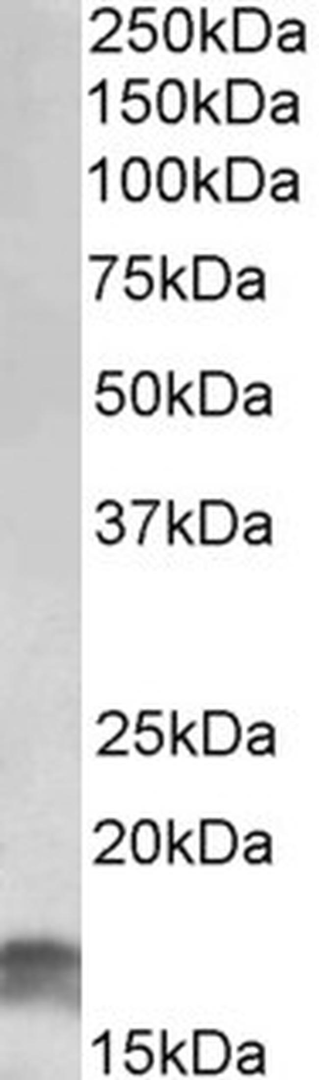 CDKN2A (Isoform 3) Antibody in Western Blot (WB)