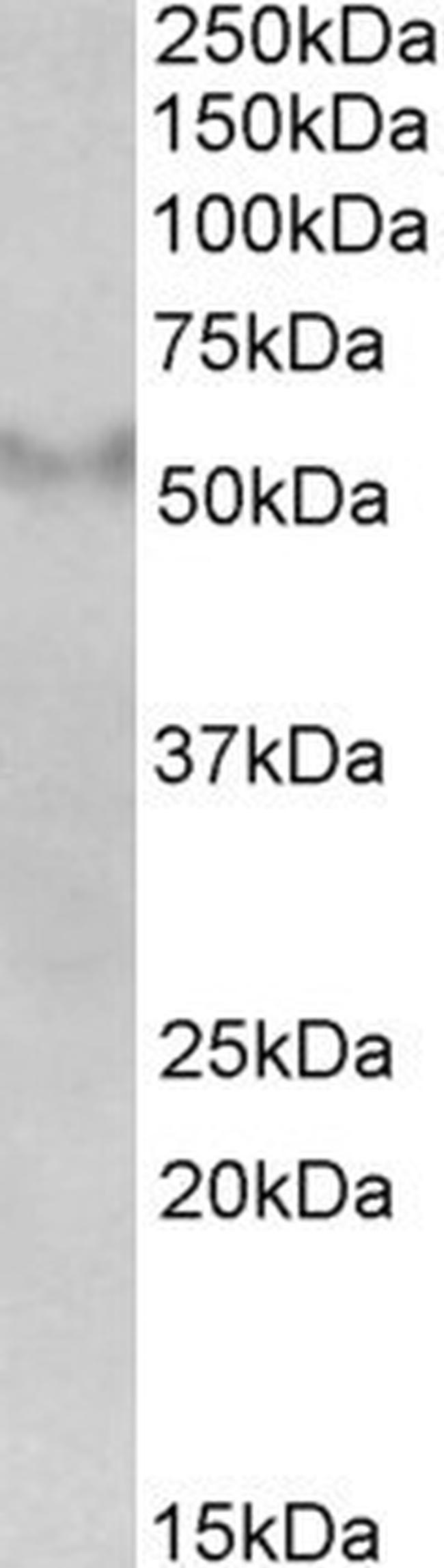 FSD1 Antibody in Western Blot (WB)