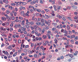 Prostaglandin E Receptor EP1 Antibody in Immunohistochemistry (Paraffin) (IHC (P))