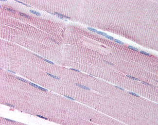 SORBS1 Antibody in Immunohistochemistry (Paraffin) (IHC (P))